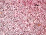 3 - Cellule corticali in visione superficiale